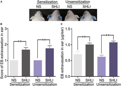 RhoA/ROCK Signaling Pathway Mediates Shuanghuanglian Injection-Induced Pseudo-allergic Reactions